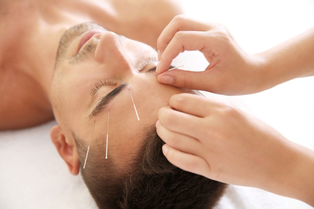 man receiving facial acupuncture